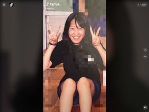 Transformasi Wanita yang Jadi Kontroversi, Operasi Plastik Sejak Kelas 5 SD Transformasi Wanita yang Jadi Kontroversi, Operasi Plastik Sejak Kelas 5 SD