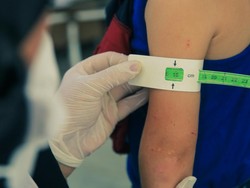 Tangani Stunting, Dinkes DKI Sebut Aktif Telusuri Kasus-Beri Makan Tambahan