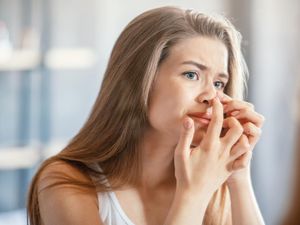 5 Cara Mengatasi Jerawat di Hidung 5 Cara Mengatasi Jerawat di Hidung