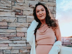 Model 31 Tahun Idap Kondisi Langka, Kulit Penuh Keriput Seperti Usia 70-an