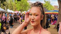 8 Potret Model dengan Kondisi Langka, Kulit Keriput di Usia 31 Tahun