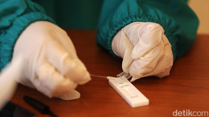 Tes Swab Terus Digalakkan di Tengah Meningkatnya Kasus COVID-19 Baru Sejumlah jurnalis menjalani test swab antigen di Kantor BPOM, Jakarta, Kamis (17/11/2022). Indonesia mencatat sebanyak 7.822 problem gres COVID-19, Kamis (17/11/2022), Kasus aktif kini sebanyak 60.471 kasus.