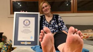 6 Foto Wanita Pemilik Kaki Terbesar di Dunia