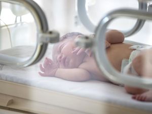 Terungkap! Bayi Prematur yang Sekilas Berkaki Enam Ternyata Kembar Siam