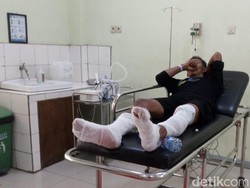 Kaki Pemilik Pom Mini di Ciamis Terbakar!