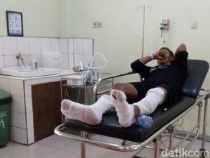 Kaki Pemilik Pom Mini di Ciamis Terbakar! Kaki Pemilik Pom Mini di Ciamis Terbakar!