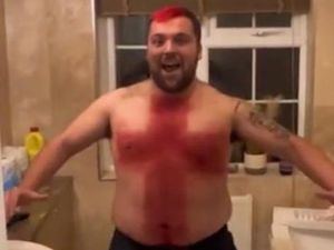 Dukung Inggris di Piala Dunia, Pria Viral Bentuk Bulu Dadanya Jadi Bendera UK