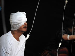 Potret Kondisi Korban Luka Gempa Cianjur Potret Kondisi Korban Luka Gempa Cianjur