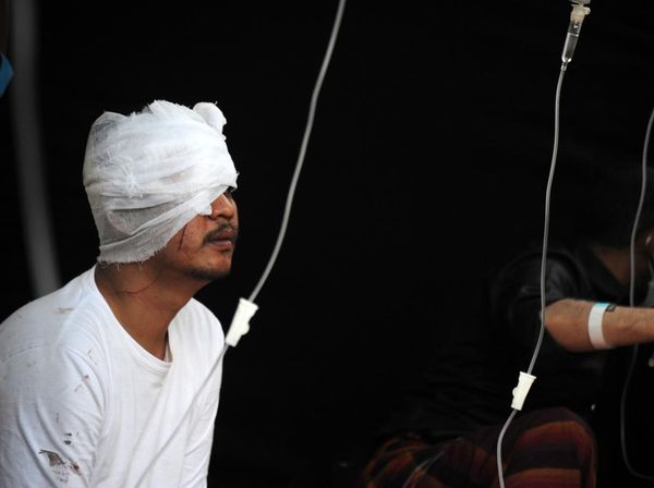 Potret Kondisi Korban Luka Gempa Cianjur