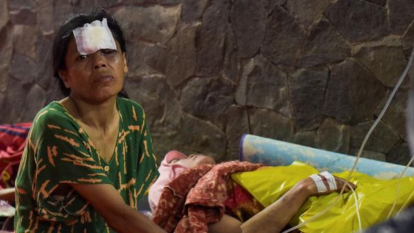 Melihat Lagi Kondisi Luka yang Diderita Korban Gempa Cianjur