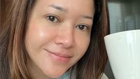 7 Wajah Maia Estianty Tanpa Makeup Setelah Perawatan Laser untuk Atasi Rosacea