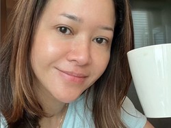 Fakta-fakta Penyakit Rosacea yang Diidap Maia Estianty, Bisa Sembuh?
