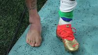 Viral Penampakan Kaki Neymar Bengkak gegara Cedera Engkel