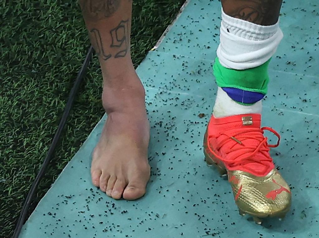 Viral Penampakan Kaki Neymar Bengkak gegara Cedera Engkel