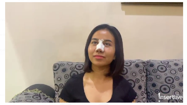 Mayang Operasi Plastik