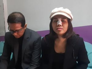 Fakta-fakta Operasi Hidung, Dijalani Mayang Demi Ubah Penampilan Fakta-fakta Operasi Hidung, Dijalani Mayang Demi Ubah Penampilan