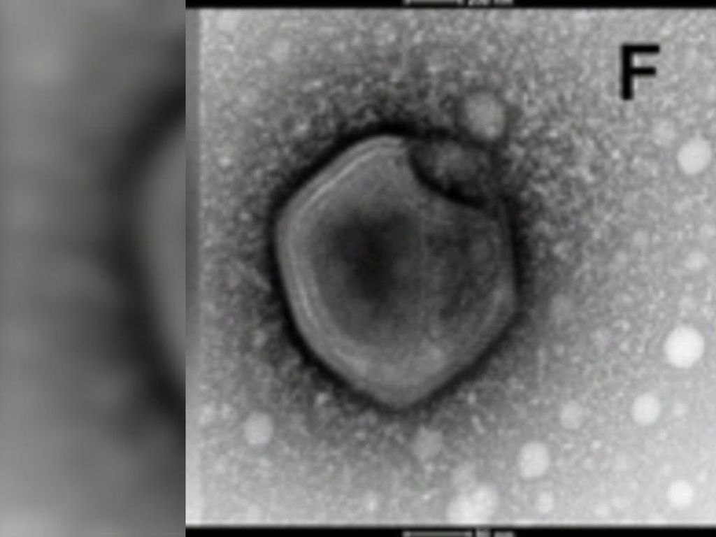Virus Zombie di Laboratorium Rusia Dikhawatirkan Bocor