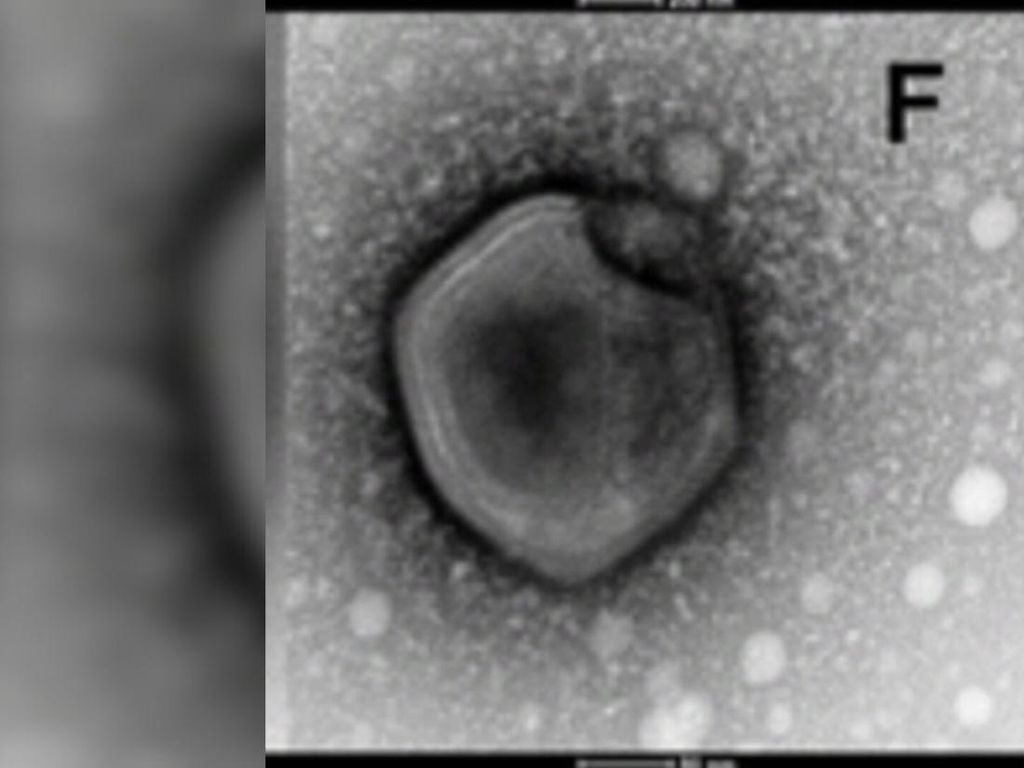 Virus Zombie di Laboratorium Rusia Dikhawatirkan Bocor Virus Zombie di Laboratorium Rusia Dikhawatirkan Bocor