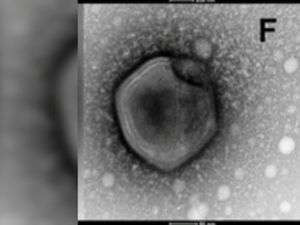 Virus Zombie di Laboratorium Rusia Dikhawatirkan Bocor Virus Zombie di Laboratorium Rusia Dikhawatirkan Bocor