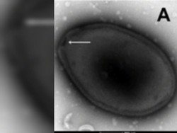 Berpotensi Jadi Pandemi Baru, Ahli Genetika Bongkar Asal-usul Virus Zombie