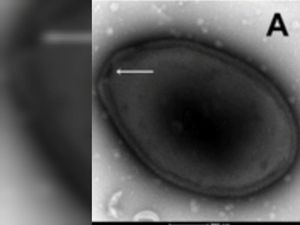 Berpotensi Jadi Pandemi Baru, Ahli Genetika Bongkar Asal-usul Virus Zombie Berpotensi Jadi Pandemi Baru, Ahli Genetika Bongkar Asal-usul Virus Zombie