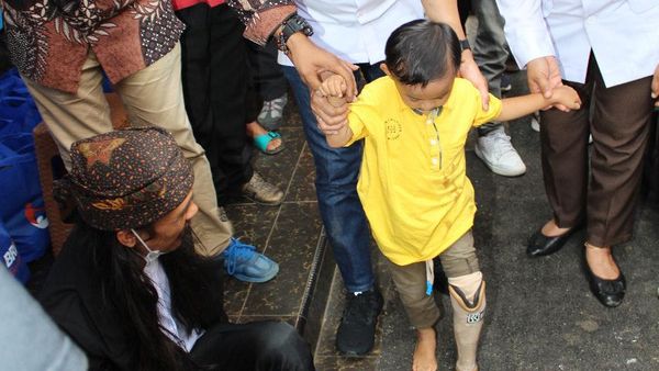 Bantuan Kaki dan Tangan Palsu Bagi Penyandang Disabilitas