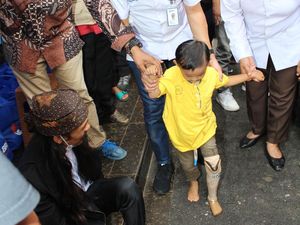 Bantuan Kaki dan Tangan Palsu Bagi Penyandang Disabilitas