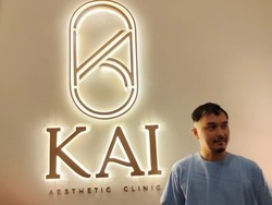 Curhat Dimas Aditya Alami Kebotakan hingga Krisis Kepercayaan Diri