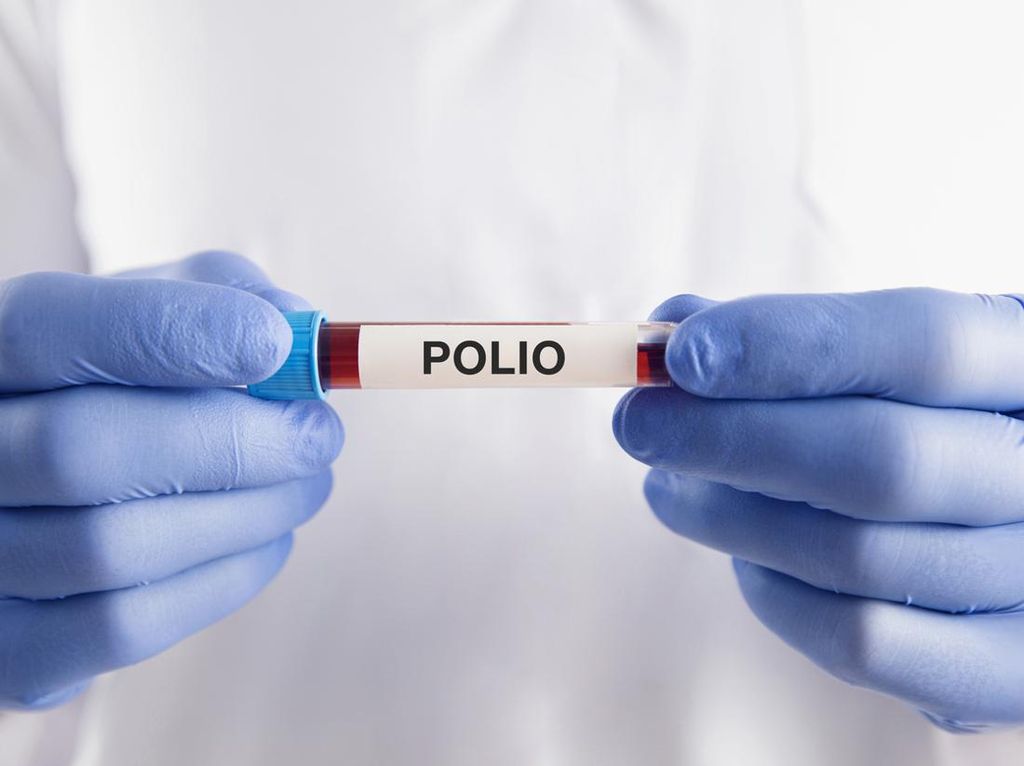 Kemenkes Singgung Herd Immunity Ngedrop Picu RI Tak Lagi Bebas Polio Kemenkes Singgung Herd Immunity Ngedrop Picu RI Tak Lagi Bebas Polio