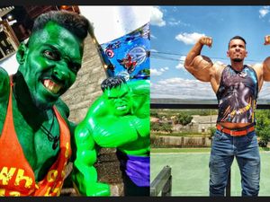 Cerita Pria Suntik Otot Pakai Minyak Biar Mirip Hulk Berujung Nyaris Amputasi Cerita Pria Suntik Otot Pakai Minyak Biar Mirip Hulk Berujung Nyaris Amputasi