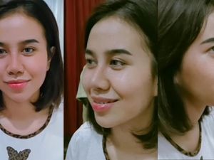 Tampilan Wajah Baru Mayang usai Operasi Hidung, Bikin Pangling? Tampilan Wajah Baru Mayang usai Operasi Hidung, Bikin Pangling?