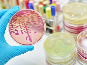 Kerap Disebut Sumber Penyakit, Ini Peran Penting Bakteri dalam Kehidupan Kerap Disebut Sumber Penyakit, Ini Peran Penting Bakteri dalam Kehidupan