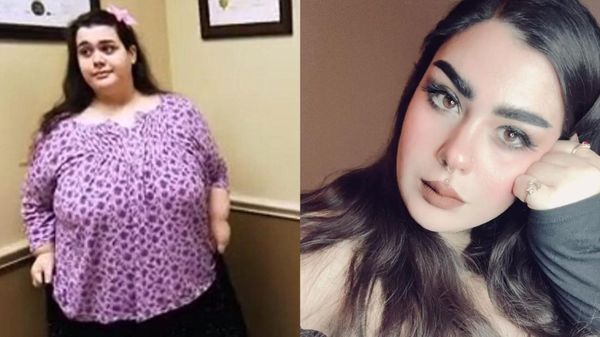Potret Transformasi Wanita yang Dulunya Berbobot 317 Kg, Kini Bikin Pangling!