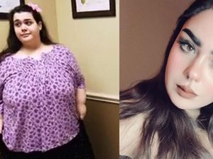 Potret Transformasi Wanita yang Dulunya Berbobot 317 Kg, Kini Bikin Pangling!