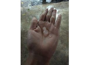 Ada Hujan Es di Mataram, Kok Bisa?