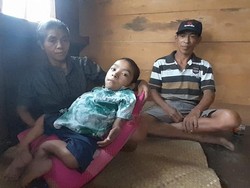 Kisah Bocah Lumpuh di Manggarai: Tak Ada Biaya Berobat-Pengin Sekolah