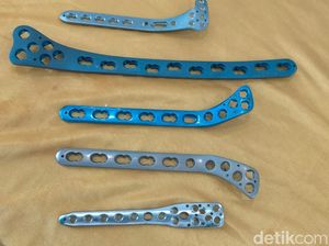 Kemenkes Apresiasi Alkes Ortopedi Produk Lokal di Pasuruan