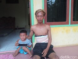 Pilu Korban Laka To Cipali: Rusuk Patah Malah Diminta Pindah Bus