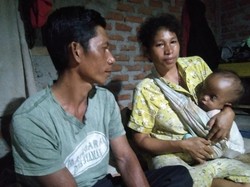 Kisah Pilu Bayi di NTT Idap Hidrosefalus, Ortu Terbentur Biaya Berobat