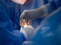 Viral Ibu Muda Meninggal Usai Lahiran Anak Ke-10, Ini Penyebabnya