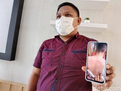 Kasus Guru SD Manado Aniaya Siswa, Pelaku Ngaku Spontan karena Tak Dihargai