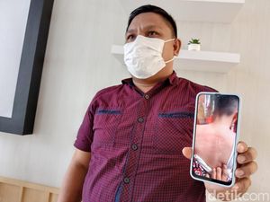 Dalih Guru SD di Manado Aniaya Siswa karena Spontan-Klaim Bentuk Pengajaran Dalih Guru SD di Manado Aniaya Siswa karena Spontan-Klaim Bentuk Pengajaran