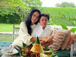 Perkembangan Kesehatan Anak Marcella Zalianty Lawan Tumor Otak