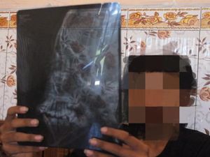 Siswa SMP di Jombang Dikeroyok Gerombolan Pesilat hingga Patah Tulang Siswa SMP di Jombang Dikeroyok Gerombolan Pesilat hingga Patah Tulang