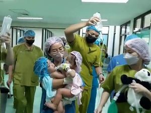 Bayi Kembar Siam Ayesha-Aleeya Asal KBB Jalani Operasi Pemisahan