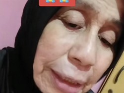 Cerita Wanita Viral Alami Penyakit Langka, Usia 28 Wajah bak Nenek-nenek
