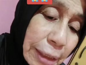 Cerita Wanita Viral Alami Penyakit Langka, Usia 28 Wajah bak Nenek-nenek Cerita Wanita Viral Alami Penyakit Langka, Usia 28 Wajah bak Nenek-nenek