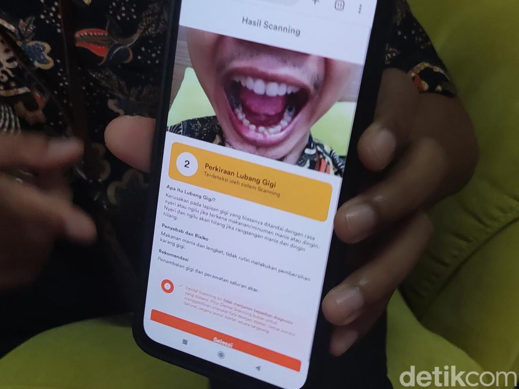 FT UGM Buat Aplikasi Cek Kesehatan Gigi Cukup Pakai Foto, Gratis Lur! FT UGM Buat Aplikasi Cek Kesehatan Gigi Cukup Pakai Foto, Gratis Lur!
