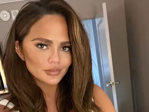 Chrissy Teigen jalani operasi menghilangkan lemak pipi.