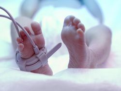 Viral Bayi Lahir dengan Mata Unik Disebut Mirip Alien, Inikah Penyebabnya? Viral Bayi Lahir dengan Mata Unik Disebut Mirip Alien, Inikah Penyebabnya?
